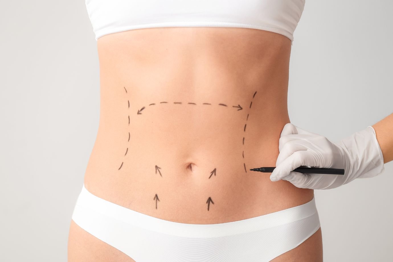 Pós-Operatório de Cirurgia Plástica: Por que a drenagem comum não é suficiente para sua recuperação?